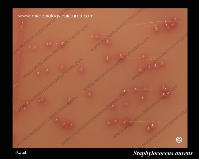MRSA colonies methicillin resistant Staphylococcus aureus (MRSA) colonies